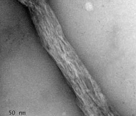 HRTEM showing the average diameter of the produced nanofibres. Diameter reduction was 4000 times.