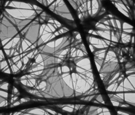 High resolution image of produced cellulose nanofibres acquired by LVEM 25, courtesy of Delong Instruments.
